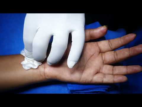 Видео: Частичная блокада запястья: срединный и лучевой нерв