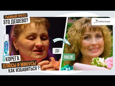 Видео: Корега - все плюсы и минусы! Как избавиться? → Дантистофф #зубныепротезы #имплантациязубов