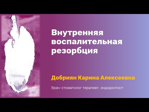 Видео: Эндогайд #2. Внутренняя воспалительная резорбция