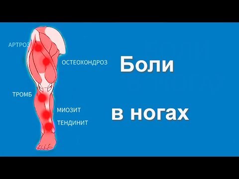 Видео: Боли в Ногах