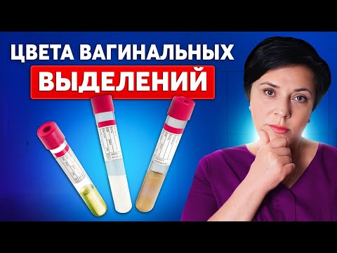 Видео: О чем говорит цвет выделений у женщин - Норма или признак инфекции?