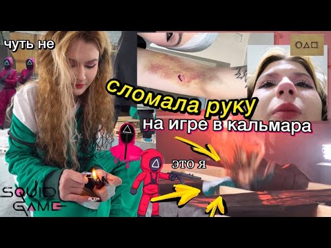 Видео: я чуть не СЛОМАЛА РУКУ на игре в кальмара ;))