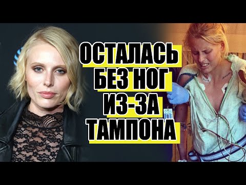 Видео: История модели Лорен Вассер, потерявшей ноги из-за тампона