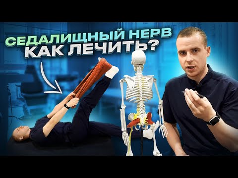 Видео: Защемление седалищного нерва. Причины , как лечить и какие упражнения помогут ?