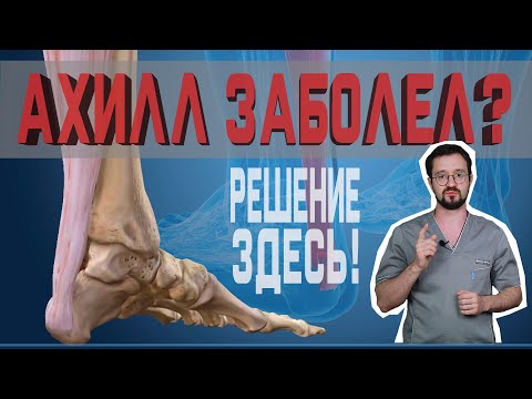 Видео: Как начать бегать после травмы ахиллового сухожилия? | Доктор Демченко