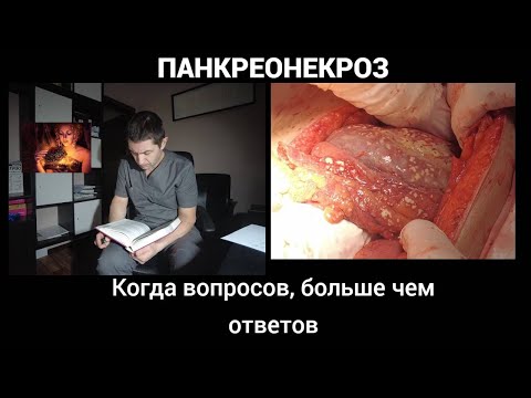 Видео: панкреонекроз. Когда вопросов, больше чем ответов.