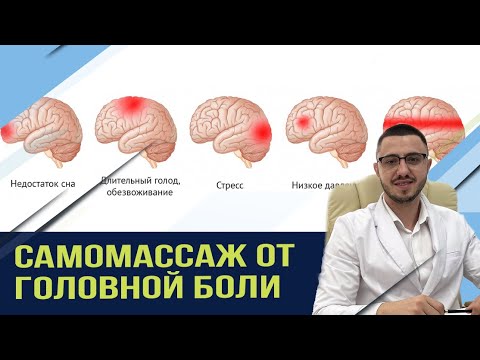 Видео: Как лечить ГОЛОВНУЮ боль