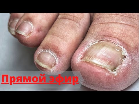 Видео: ПЕДИКЮР ОНЛАЙН. Виктория Авдеева