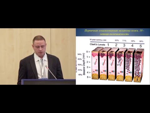 Видео: Современные методы ранней неинвазивной диагностики меланомы кожи