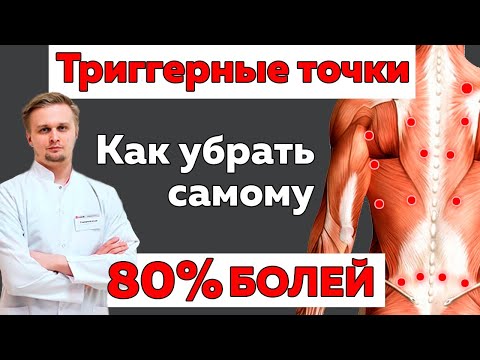 Видео: Триггерные точки - причина 80% болей. Как с ними бороться?