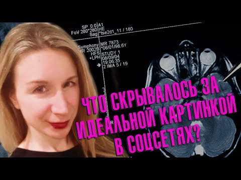 Видео: ПЕРВАЯ ЗАПОВЕДЬ ВРАЧА: НЕ НАВРЕДИ || Дело закрыто #74