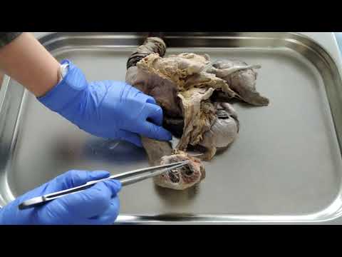 Видео: Видеозанятие 30 «Органы размножения (часть 2)»