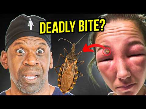 Видео: Кровососущий клоп по соседству: риски и профилактика болезни Шагаса | Доктор Крис Рейнор