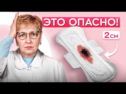 Видео: СГУСТКИ при менструации. Главные признаки НОРМАЛЬНЫХ месячных. СРОЧНО проверьте себя