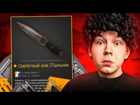 Видео: Топ Моменты CS | STROGO ВЫБИЛ НОЖ ПРЯМО В ИГРЕ
