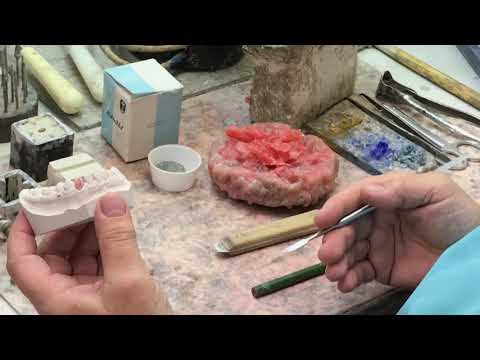 Видео: Этапы изготовления штампованной коронки