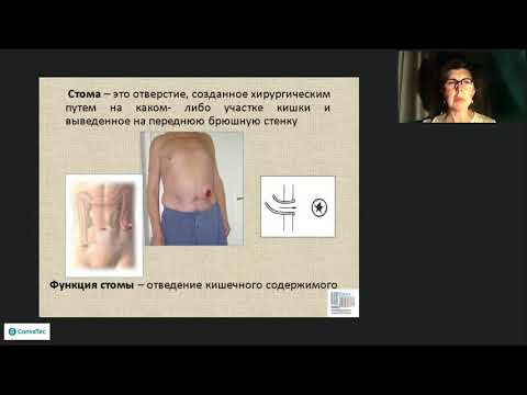 Видео: Как жить со стомой