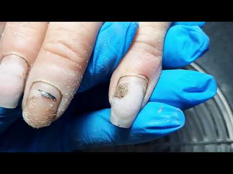 Видео: ПЛЕСЕНЬ?😱 МУЧИТЕЛЬНЫЙ МАНИКЮР 😓