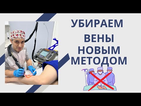 Видео: Что такое Клакс и почему он лучше склеротерапии? Флеболог Москва.