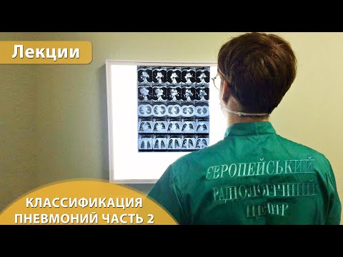 Видео: КТ пневмоний - аспирационная, некротическая пневмония, септическая эмболия. Андрей Мангов. Часть 2