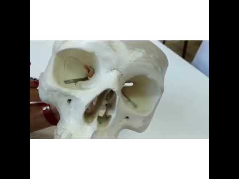 Видео: ЛИЦЕВОЙ НЕРВ (VII пара)