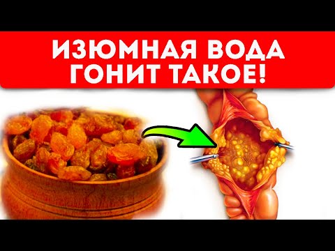Видео: Об этом мало кто знает! Здоровое пищеварение и еще 7 поразительных эффектов применения отвара изюма