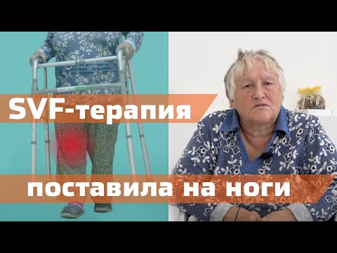 Видео: SVF-терапия в лечении гонартроза 3 степени