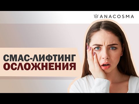 Видео: 🔥Ультразвуковой СМАС лифтинг🔥 ОСЛОЖНЕНИЯ | 🔥 Альтера | 🔥 Отзывы