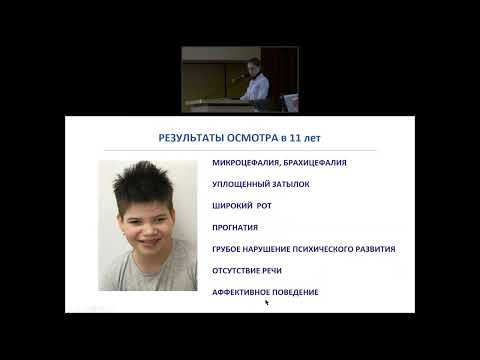 Видео: Синдром Ангельмана