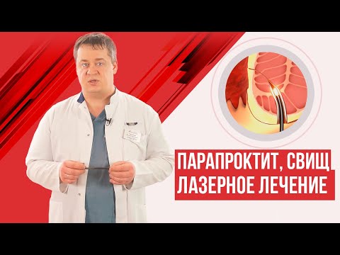 Видео: Острый парапроктит и свищ прямой кишки. Лазерное лечение.