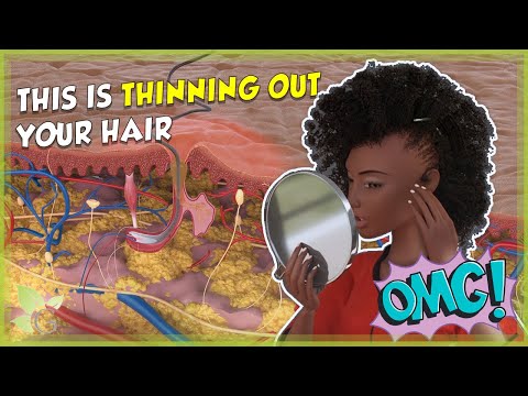 Видео: 4 причины, по которым ваши волосы редеют