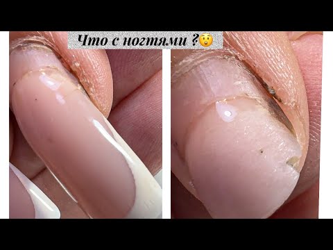 Видео: Краска на ногтях / Трещины 😳/ Сложная коррекция 
