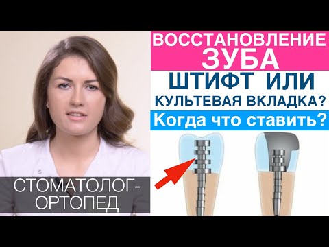 Видео: Штифт, культевая вкладка или Build-up - что лучше? Каким способом восстановить зуб в каких случаях.