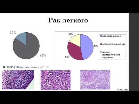 Видео: Общество онкологов ГБУЗ «ЧОКЦОиЯМ» 20.10.2021