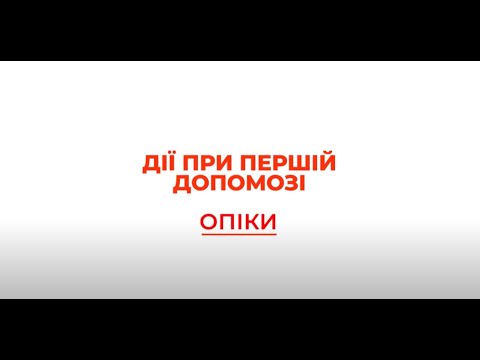 Видео: Перша допомога:  опіки