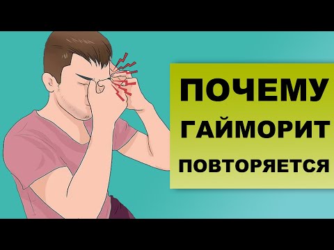 Видео: ПОЧЕМУ ГАЙМОРИТ ПЕРЕХОДИТ В ХРОНИЧЕСКИЙ?
