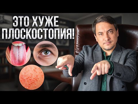 Видео: НЕИЗВЕСТНЫЕ БОЛЕЗНИ, ИЗ-ЗА КОТОРЫХ МОГУТ НЕ ВЗЯТЬ В АРМИЮ!
