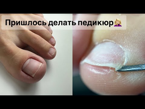 Видео: ДЕЛАЮ ПЕДИКЮР ОНЛАЙН. Виктория Авдеева