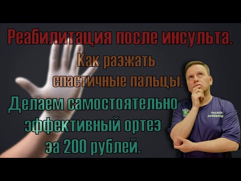 Видео: Как разжать пальцы на руке при спастике после инсульта. Ортез за 200 рублей.