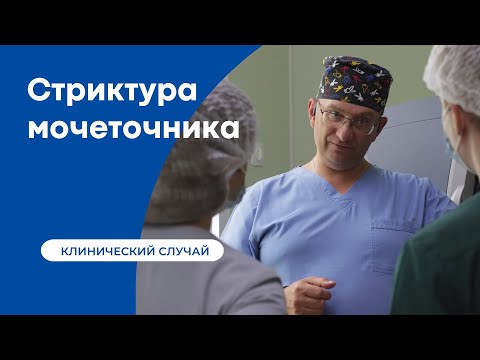 Видео: Лечение стриктуры мочеточника - отзыв нашего пациента