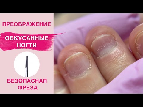 Видео: Наращивание ногтей на обкусанные ногти | Маникюр безопасная фреза