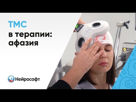 Видео: Транскраниальная магнитная стимуляция (ТМС) в терапии: афазия