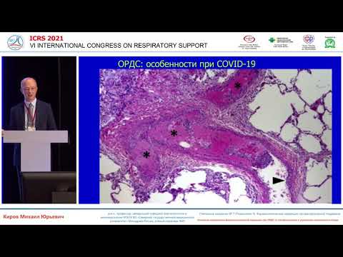 Видео: Фармакологическое лечение ОРДС Киров МЮ