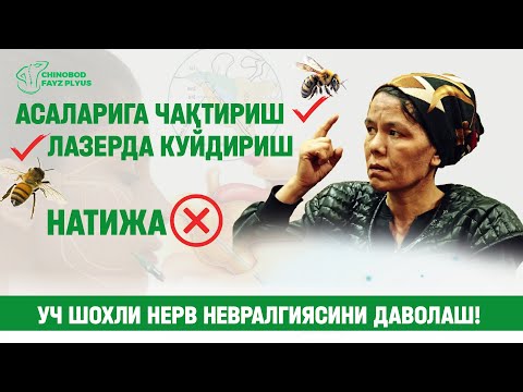 Видео: УЧ ШОХЛИ НЕРВ НЕВРАЛГИЯСИ ДАВОЛАШ!
