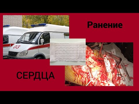 Видео: Ранение сердца