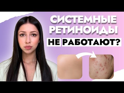 Видео: Почему системные ретиноиды НЕ ПОМОГАЮТ при акне? 
