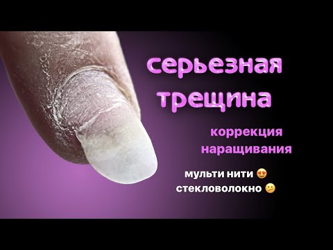 Видео: глубокая трещина 🙄 быстрая коррекция наращивания, ремонт полимерными нитями