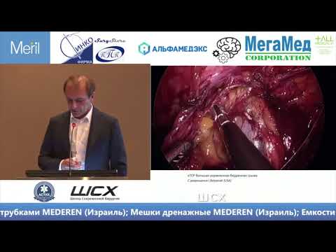Видео: Аболмасов А. Ущемленная грыжа
