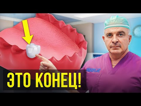 Видео: Почему НЕЛЬЗЯ допускать ОТСУТСТВИЯ ЗУБОВ! Ужасные последствия…