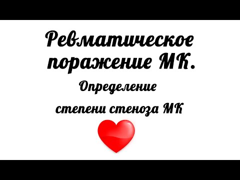 Видео: Ревматическое поражение митрального клапана. Митральный стеноз 2 степени. Способы определения МС.